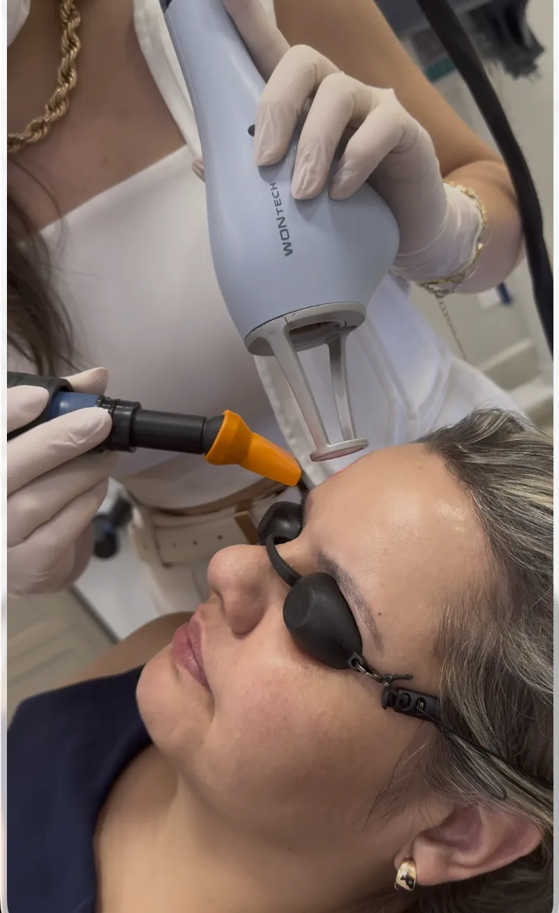 Dra. Isabella Aquino aplicando o laser no rosto de uma paciente